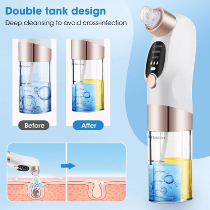 Super Micro Bubble Instrument – Skin Cleansing Device