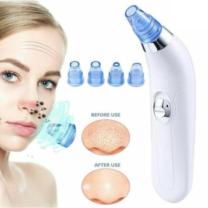 Derma Suction Cell Operated – Blackhead Remover Vacuum Tool